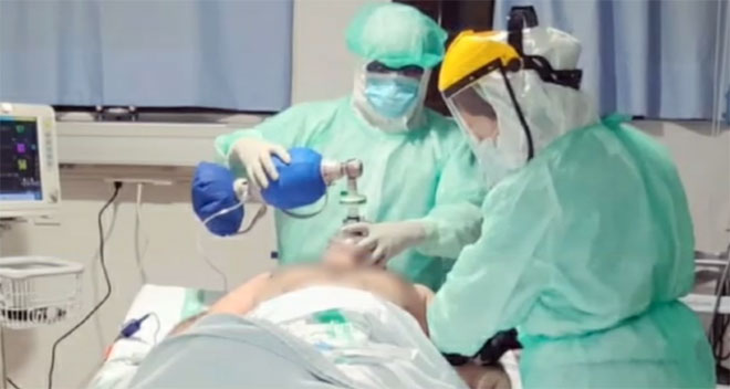 Otra secuela de la COVID 19: La disfagia afecta al 10% de los pacientes intubados