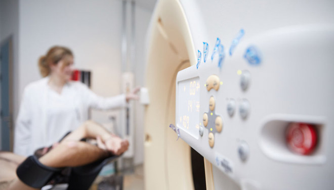 Un diagnóstico precoz podría aumentar la curación del cáncer de pulmón según un estudio de la SEOM