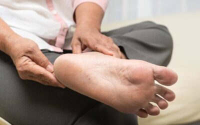 Los expertos destacan la importancia del cuidado de los pies, sobre todo en pacientes con enfermedades reumáticas