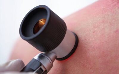 Los dermatólogos y alergólogos advierten de que la dermatitis atópica afecta de lleno a la calidad de vida de los más pequeños